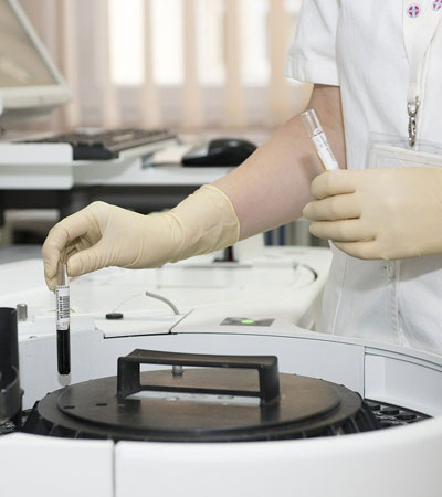 donna con provetta donna con provetta